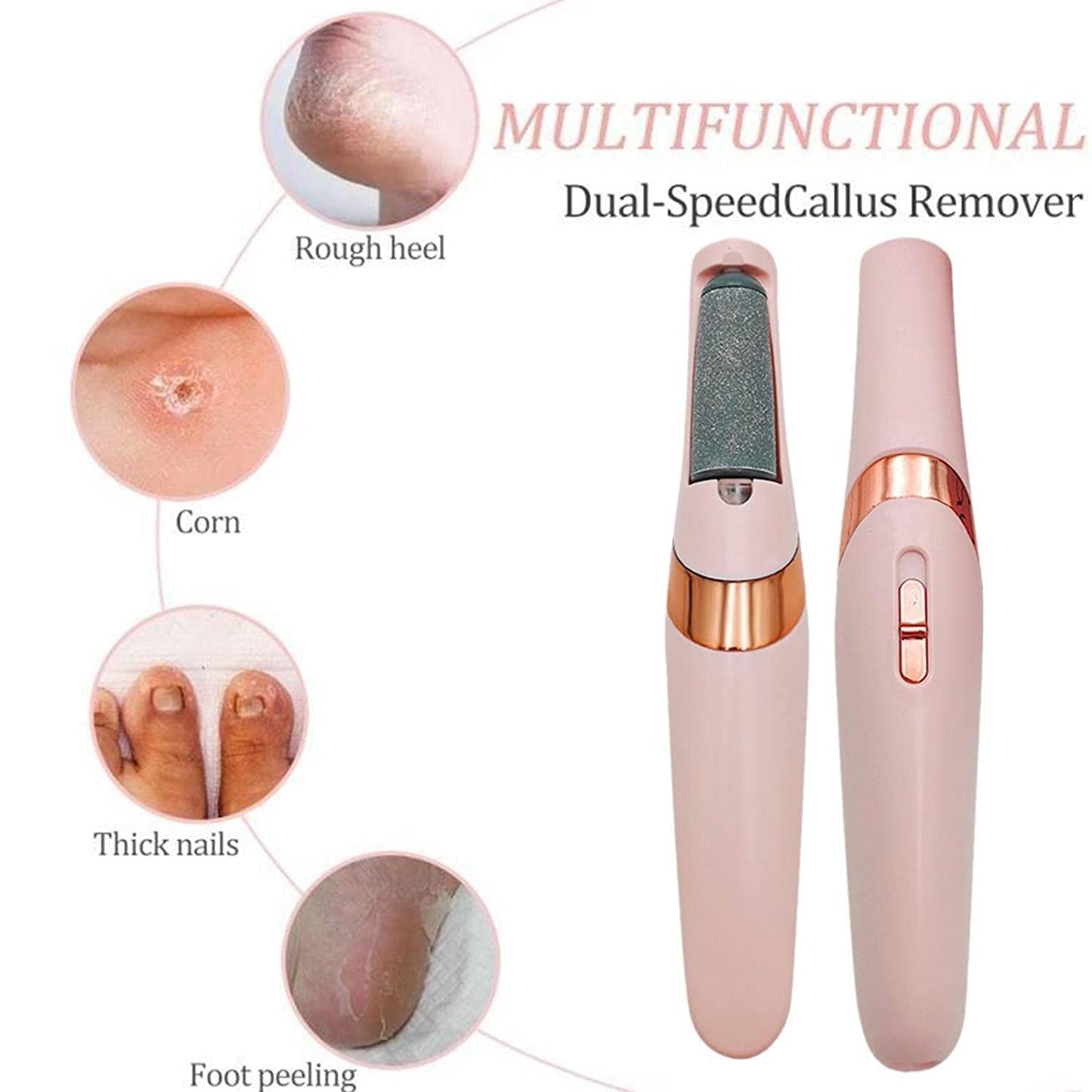 Callus Remover Rechargeable Pedicure Tool for Dead Skin |Foot Roller Callus Remover Hard and Dead Skin Remover |Feet Care Callus Remover | Pedicure for Hard Cracked Skin, Foot Scrubber Roller